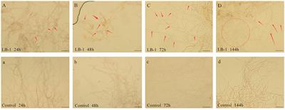 Antifungal metabolites of biocontrol stain LB-1 and their inhibition mechanism against Botrytis cinerea